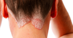 Efectos de dormir con el cabello mojado en su suavidad